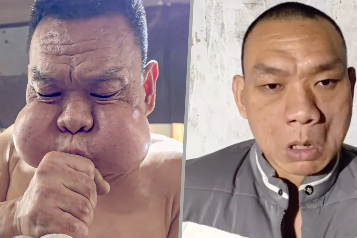 China’s ‘Frog Prince’ Glassblower Shows the Hidden Cost of a Lifetime at the Furnace