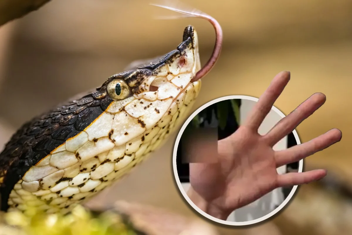 Chinese Man Loses Thumb After Hand Feeding Pet Viper Sparks Warning on Exotic Pets